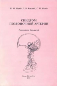 Книга Синдром позвоночной артерии. Руководство для врачей.