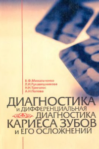 Книга Диагностика и дифференциальная диагностика кариеса зубов и его осложнений