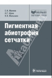 Книга Пигментная абиотрофия сетчатки: руководство