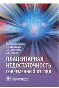 Книга Плацентарная недостаточность. Современный взгляд