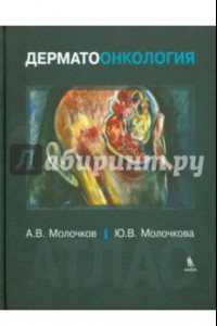 Книга Дерматоонкология. Атлас