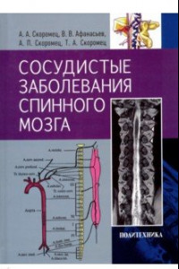 Книга Сосудистые заболевания спинного мозга. Руководство для врачей