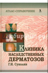 Книга Клиника наследственных дерматозов. Атлас-справочник