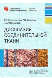 Книга Дисплазия соединительной ткани