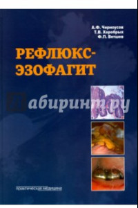 Книга Рефлюкс-эзофагит