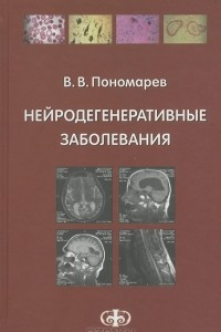 Книга Нейродегенеративные заболевания. Руководство для врачей