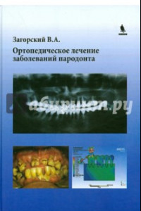 Книга Ортопедическое лечение заболеваний пародонта