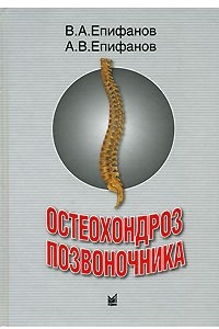 Книга Остеохондроз позвоночника