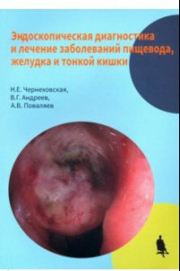 Книга Эндоскопическая диагностика и лечение заболеваний пищевода, желудка и тонкой кишки