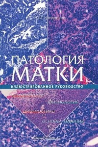 Книга Патология матки