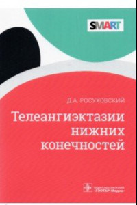 Книга Телеангиэктазии нижних конечностей