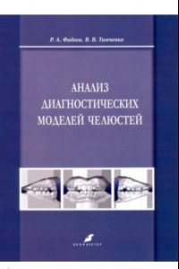 Книга Анализ диагностических моделей челюстей