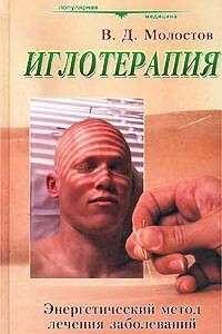 Книга Иглотерапия. Энергетический метод лечения заболеваний