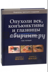 Книга Опухоли век, конъюктивы и глазницы. Атлас и справочник. Том первый