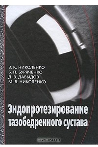 Книга Эндопротезирование тазобедренного сустава