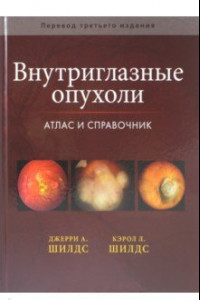 Книга Внутриглазные опухоли. Атлас и справочник